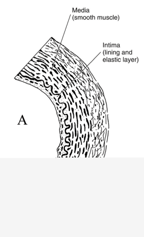 Artery Micro-Structure Artery Micro-Structure
